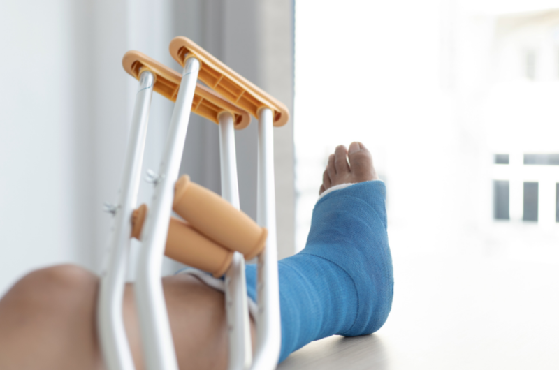 Can a Dog Bite Break a Bone?